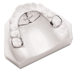 Orthodontic Appliances | Orthodontist in Ocoee FL